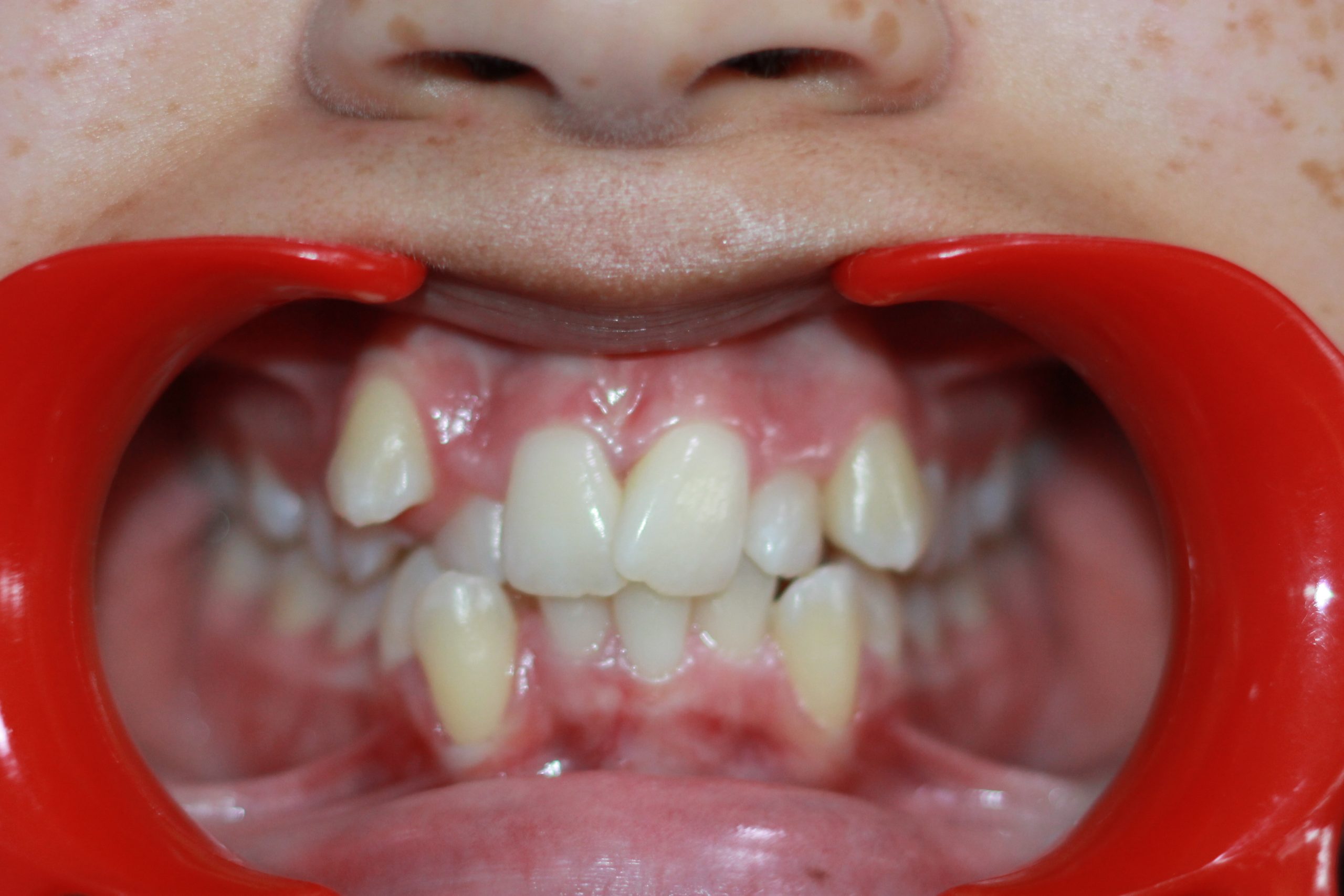 denton orthadontist