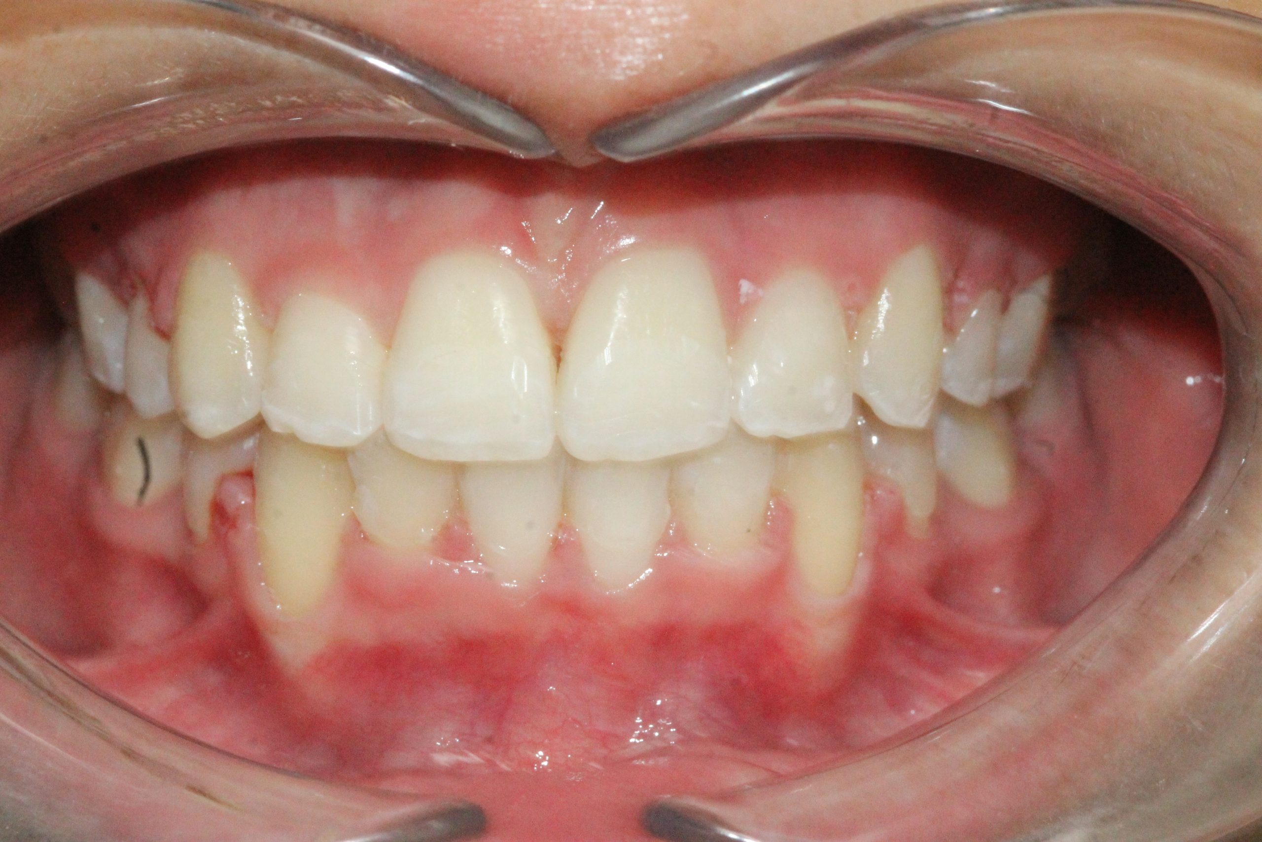 denton orthadontist